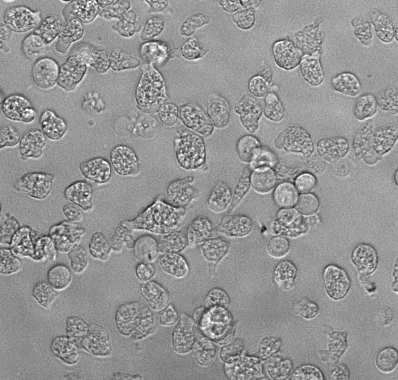 Mozkožrout, PAME, bakterie, epidemie, Ústí nad Labem, Domácí