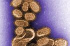 Kolorovaný obrázek viru H1N1, který způsobil španělskou chřipku, zachycený o mnoho let později elektronkovým mikroskopem. V roce 1918 ještě původce nemoci přesně neznali, a proto bylo velmi těžké se jí bránit.