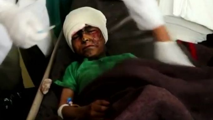 Nálet koalice vedené Saúdskou Arábií zasáhl na tržišti na severu Jemenu autobus plný dětí. Zemřelo jich na čtyři desítky. Oblast ovládají povstalci.