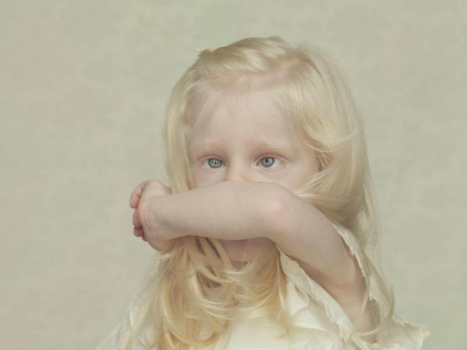 Fotografie albínů od Gustavo Lacerdy