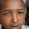 Etiopie-klinika