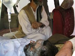 Muž zraněný při výbuchu je převážen taxíkem do nemocnice v Kunduzu.