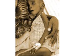 Sucho a nemoci vytvořily "smrtící koktejl". Miliony dětí zasáhlo letošní sucho ve Východní Africe. Dítě s matkou v nemocnici v severokeňském Lodwaru.