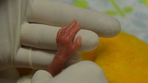 Rodičky pomohly v Podolí zachránit miminko vážící 322 gramů. To už je opravdu extrém, říká lékařka