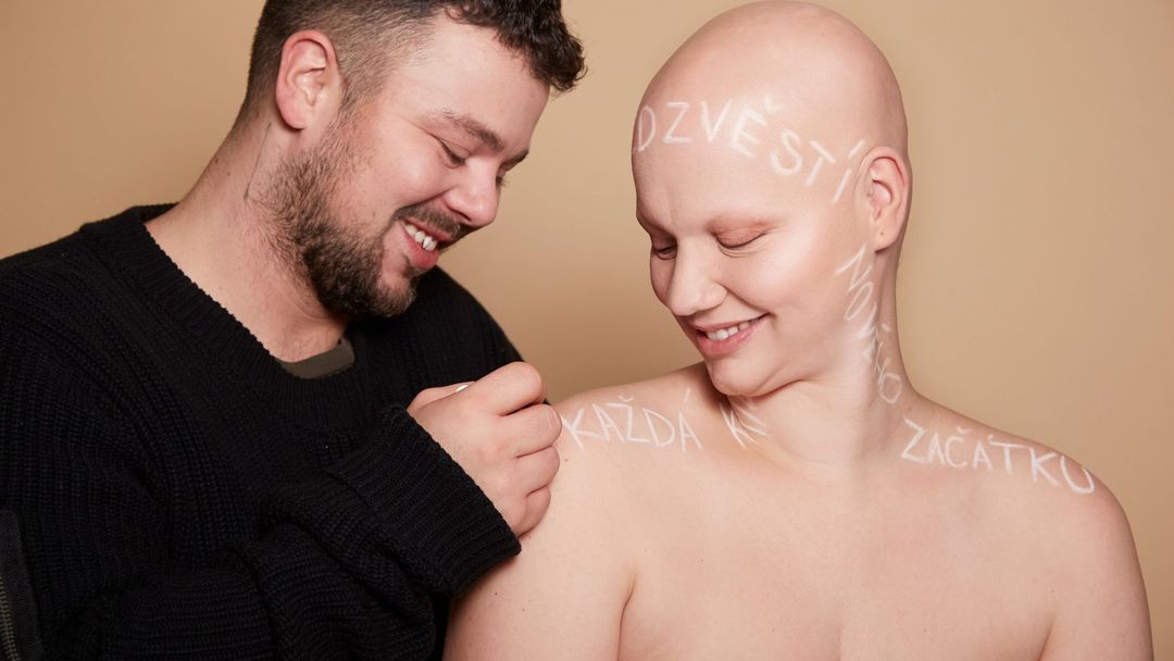 Projekt Poselství podporuje tisíce lidí, které připravila o vlasy alopecie, rakovina nebo jiná nemoc.