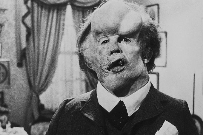 John Hurt ve filmu Sloní muž.