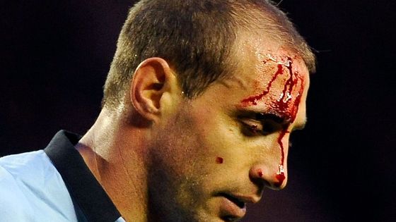 Zkrvavený obránce Manchesteru City Pablo Zabaleta.