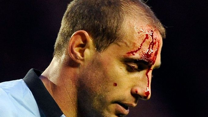 Defenzivní borec Manchesteru City Pablo Zabaleta odešel z trávníku v Sunderlandu se zkrvavenou hlavu, aby se po ošetření zase vrátil do hry.