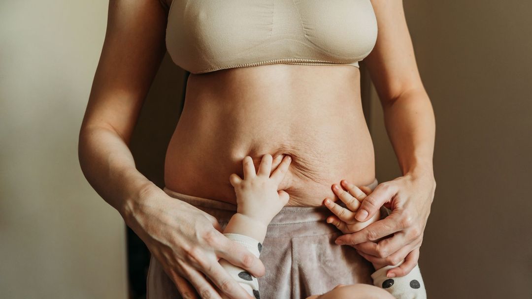 Strie a povolenou kůži po porodu na Instagramu zveřejňuje minimum žen.