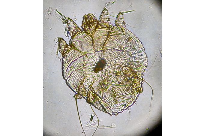 Zákožka svrabová pod mikroskopem. Ilustrační snímek