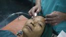 A doctor checks the eye of a patient with cataract after she receives anesthesia at the Tilganga Eye Center in Kathmandu April 25, 2012. About 150,000 of Nepal's 26.6 million people are estimated to be blind in both eyes, most of them with cataracts. Picture taken April 25, 2012. REUTERS/Navesh Chitrakar (NEPAL - Tags: HEALTH SOCIETY POVERTY) Published: Kvě. 2, 2012, 5:26 dop.