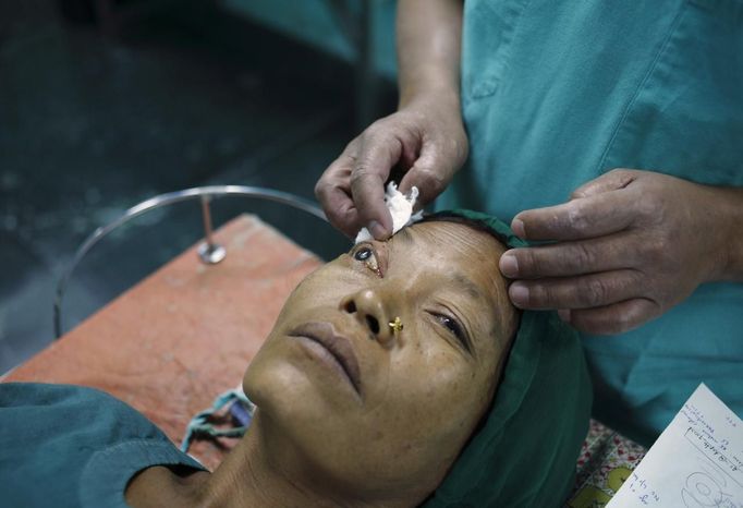 A doctor checks the eye of a patient with cataract after she receives anesthesia at the Tilganga Eye Center in Kathmandu April 25, 2012. About 150,000 of Nepal's 26.6 million people are estimated to be blind in both eyes, most of them with cataracts. Picture taken April 25, 2012. REUTERS/Navesh Chitrakar (NEPAL - Tags: HEALTH SOCIETY POVERTY) Published: Kvě. 2, 2012, 5:26 dop.