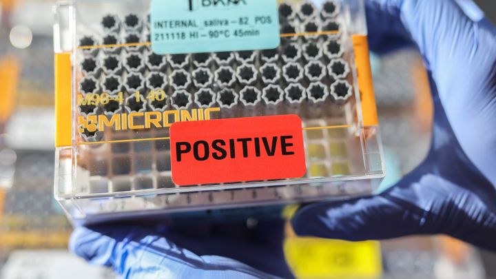 Epidemie zrychluje. V pondělí přibylo poprvé od dubna více než 2000 případů za den; Zdroj foto: Jakub Plíhal