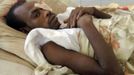 Soldier wounded as South Sudan took control of the Heglig oil field, rests at a military hospital in Khartoum