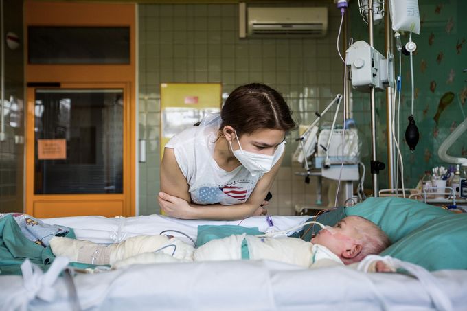 Lékaři zachránili život jedenapůlroční těžce popálené Julii, která do Prahy z Ukrajiny dorazila v kritickém stavu.