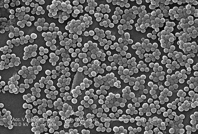 Methicilin-rezistentní zlatý stafylokok (MRSA).