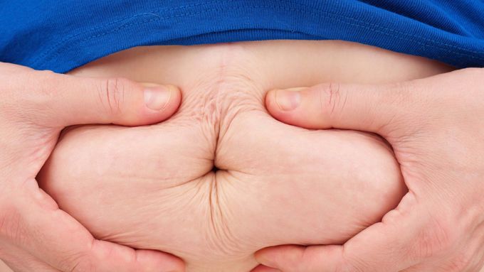 Na Slovensku trpí nadváhou nebo obezitou zhruba každý sedmý žák ve věku 11 až 15 let. U dospělé populace v zemi je výskyt nadváhy ještě rozšířenější.