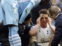 Mario Balotelli měl být v nedělním zápase s Tottenhamem vyloučen, vstřelil ale vítězný gól