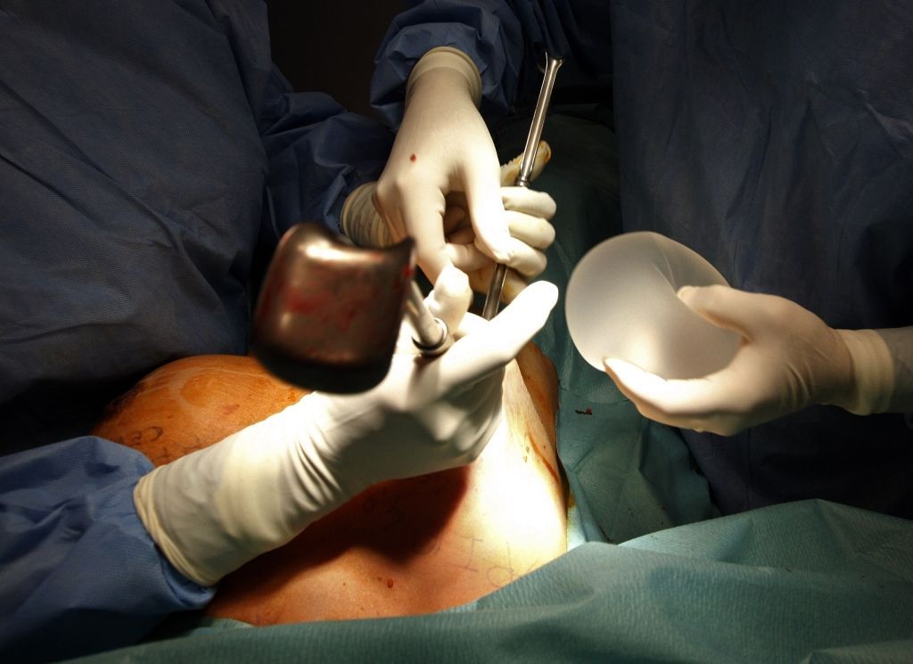 Defektní silikonové prsní implantáty společnosti PIP