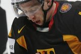 Německý hokejista Michael Wolf kontroluje rozsah škod poté, co ho v zápae se Spojenými státy do obličeje trefil puk.