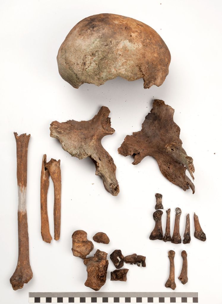 praxe soudní antropoložky Hany Eliášové