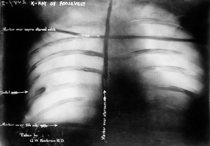 Atentáty na prezidentské kandidáty v USA. Theodore Roosevelt, rok 1912.