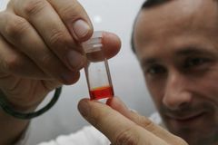 Čeští vědci mají novu zbraň na cukrovku