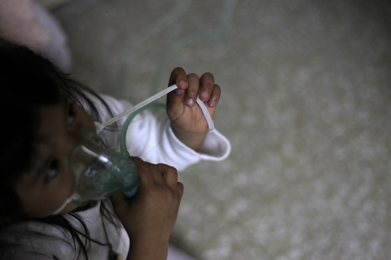 Mají AIDS a čekají na smrt. Fotoreportáž z dětského hospicu v Guatemale.