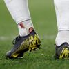 fotbal, odveta čtvrtfinále Evropské ligy, Chelsea - Slavia, zranění Edena Hazarda