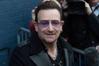 Bono Vox po pádu z kola dostal 18 šroubů a 3 kovové destičky