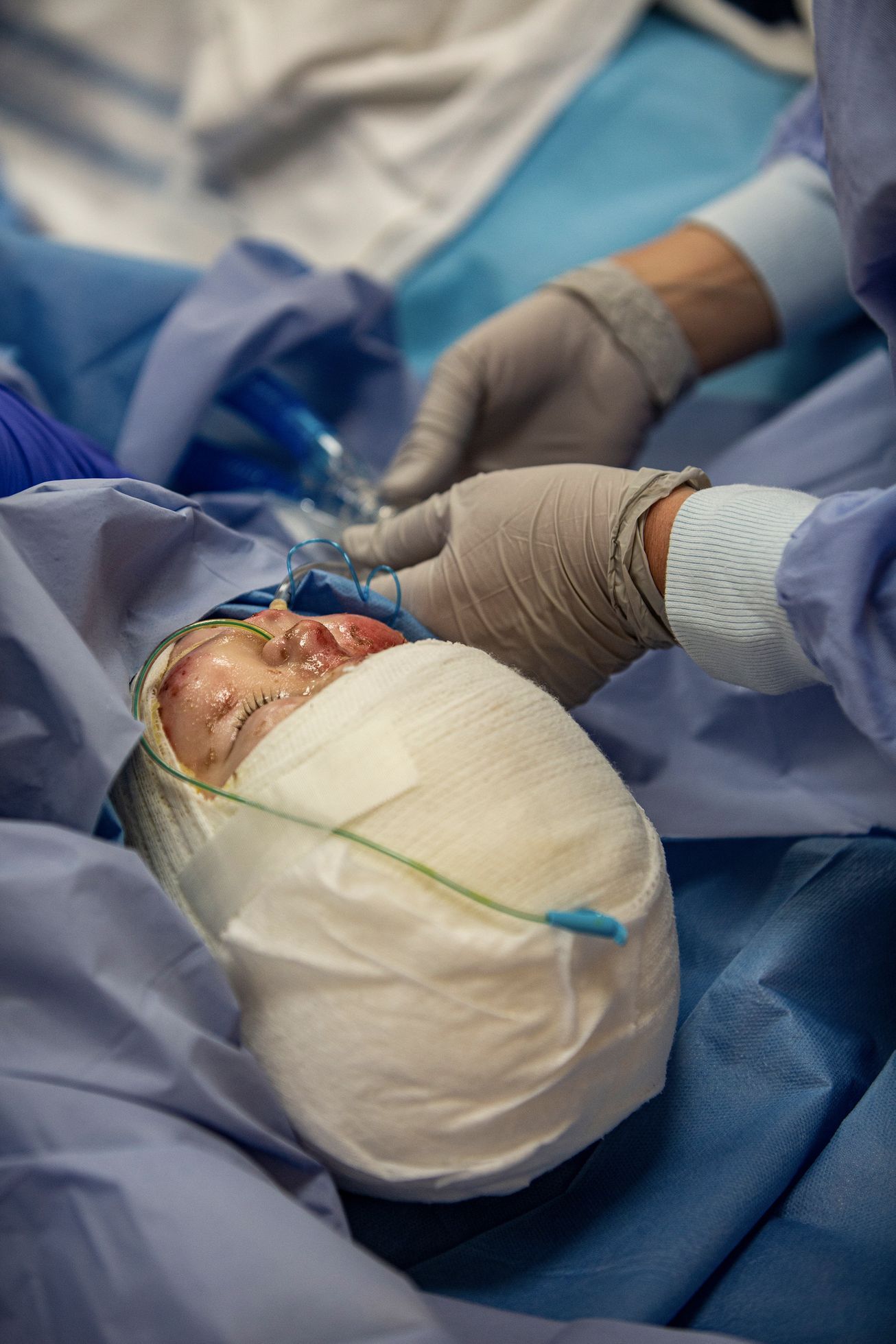 Operace popálená Julie ukrajina válka nemocnice