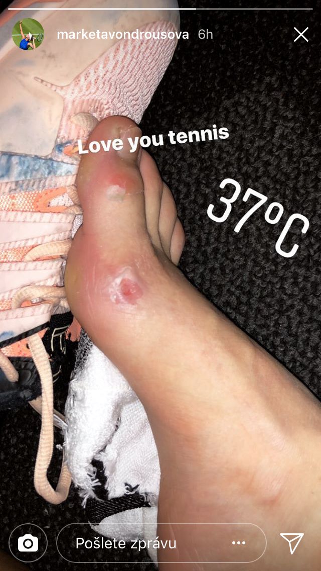 Vondroušová sedřená noha Australian Open