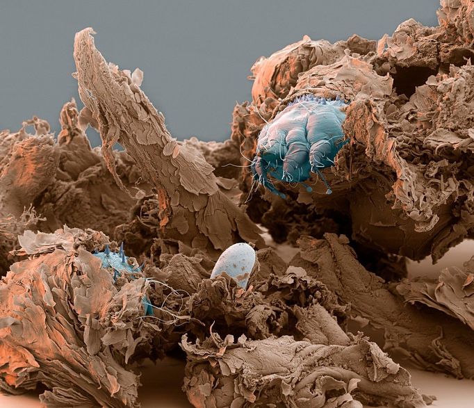 Scabies mites. Coloured scanning electron micrograph of two itch mites (Sarcoptes scabiei, blue) and an egg (centre) in a sample of dog skin (brown).