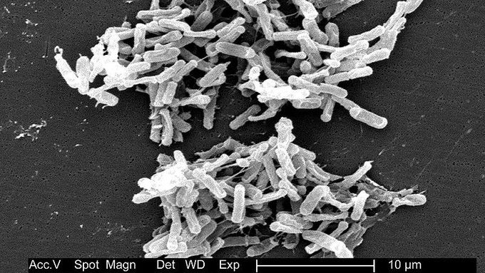 Clostridium sporogenes je neškodná. Její příbuzná C. difficile (na snímku) však způsobuje vážná onemocnění