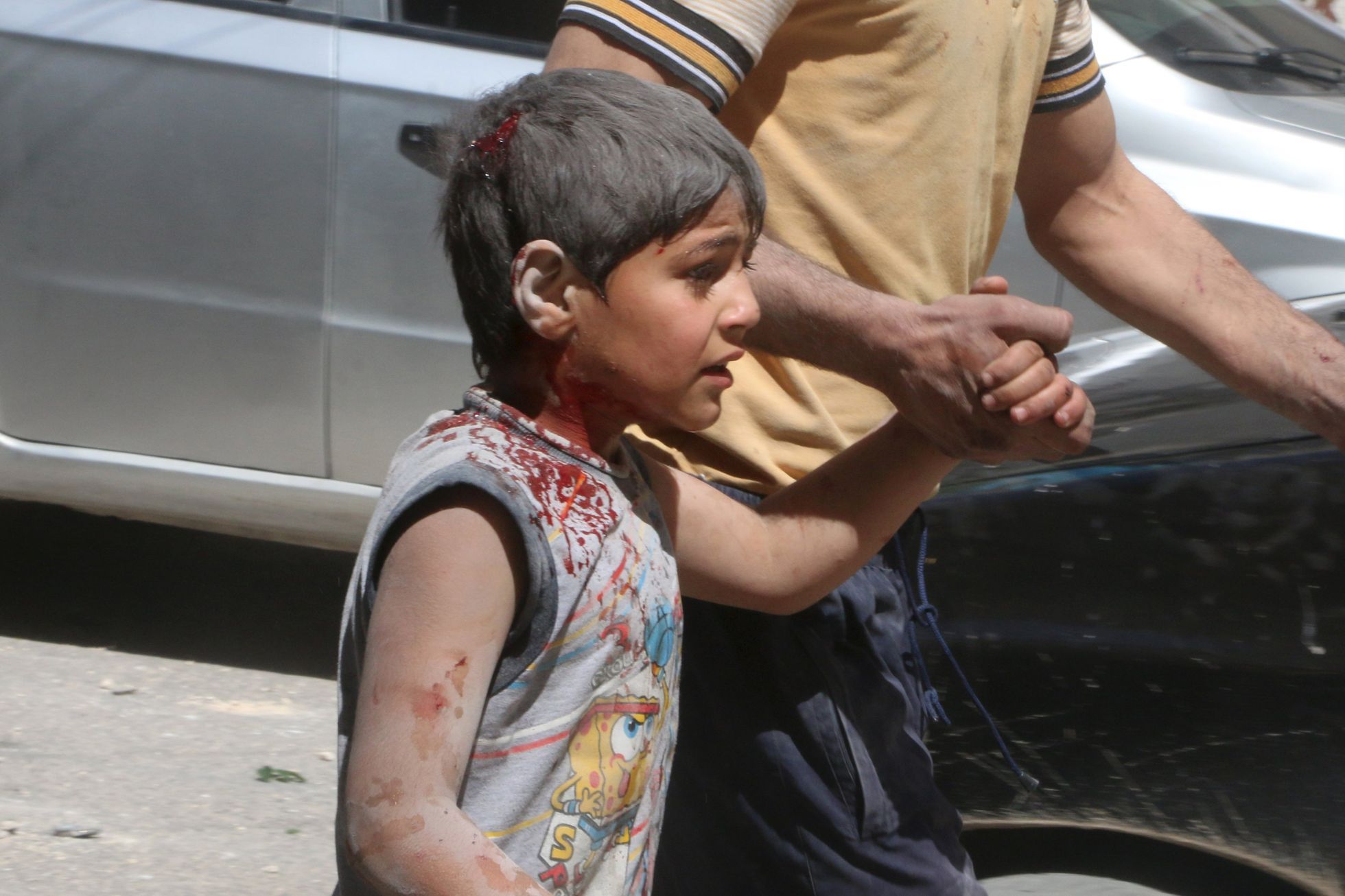 Chlapec raněný při útoku v povstalci kontrolované části Aleppa