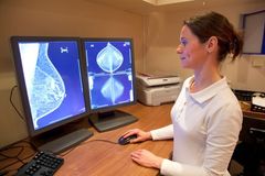 Umělá inteligence pomáhá lékařům v prevenci rakoviny prsu