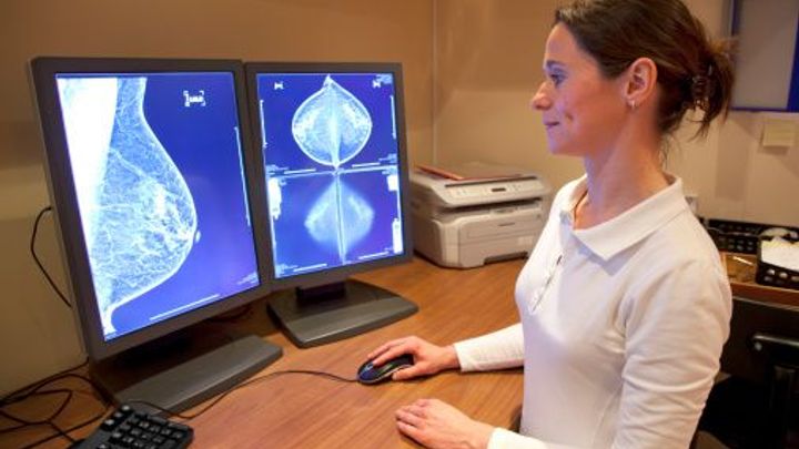 Umělá inteligence pomáhá lékařům v prevenci rakoviny prsu; Zdroj foto: Thinkstock