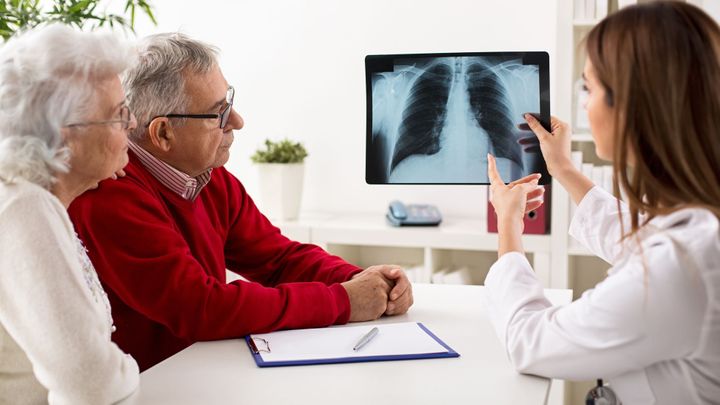 Jeden nádor vyléčí, po čase udeří rakovina jinde. Lidí s vícečetnými nádory přibývá