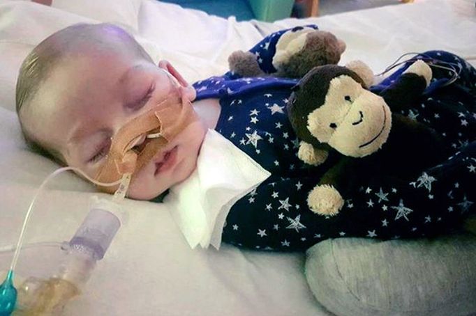 Nevyléčitelně nemocný Charlie Gard.