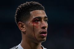 Nechutné scény na San Bernabéu. Hvězdy Realu neunesly domácí blamáž s Vigem