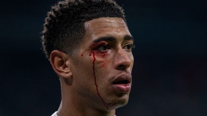 Zraněný Jude Bellingham v utkání Realu Madrid se Celtou Vigo