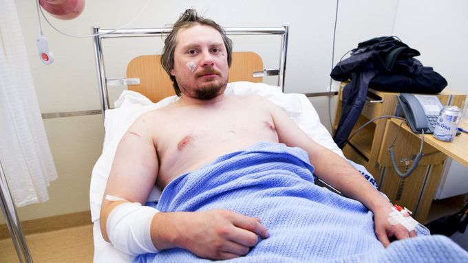 Jakub Moravec se zotavuje z útoku ledního medvěda v nemocnici na souostroví Špicberky.