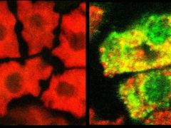 Vlevo buňky ze semínek běžné sóji, vpravo buňky obsahující vakcínu (obarvena zeleně).