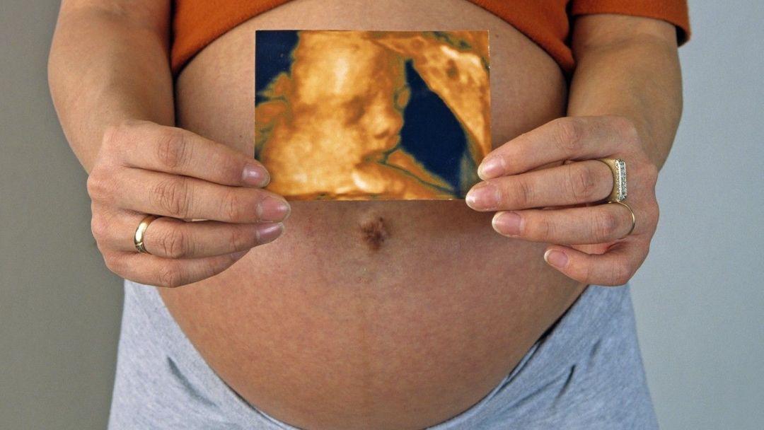 Těhotná