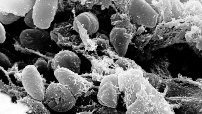 Yersinia Pestis, bakterie způsobující mor.