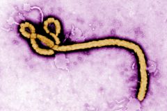Mali oznámilo druhé úmrtí na ebolu, zemřel zdravotník