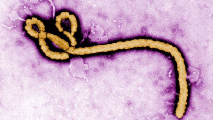 Lékaři ve Španělsku zkouší bojovat s virem eboly experimentálními způsoby léčby.