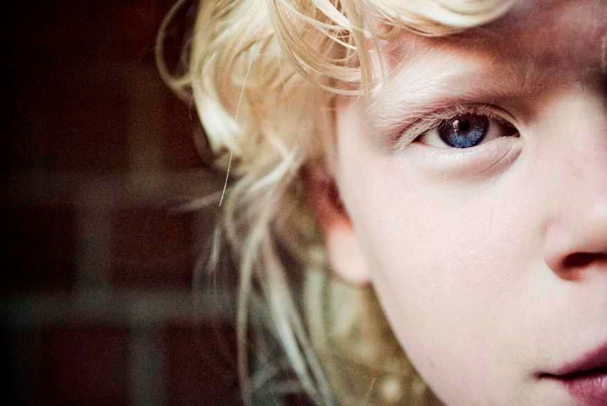 V černošské rodině se narodili tři albíni