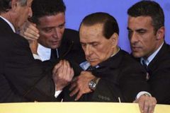 Berlusconi byl propuštěn z nemocnice