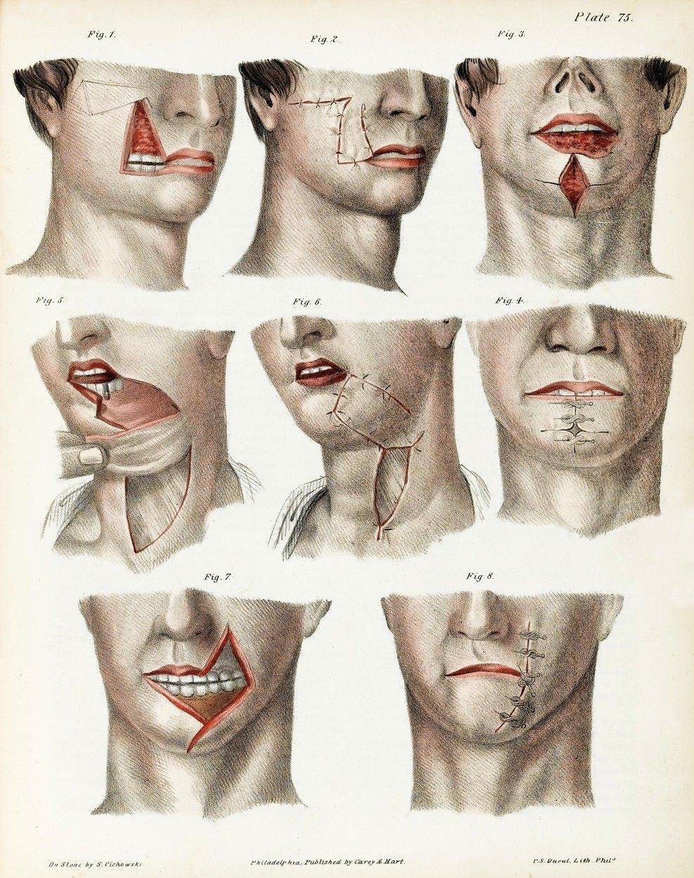 Plastická chirurgie, historie, Žena.cz, codagalerie